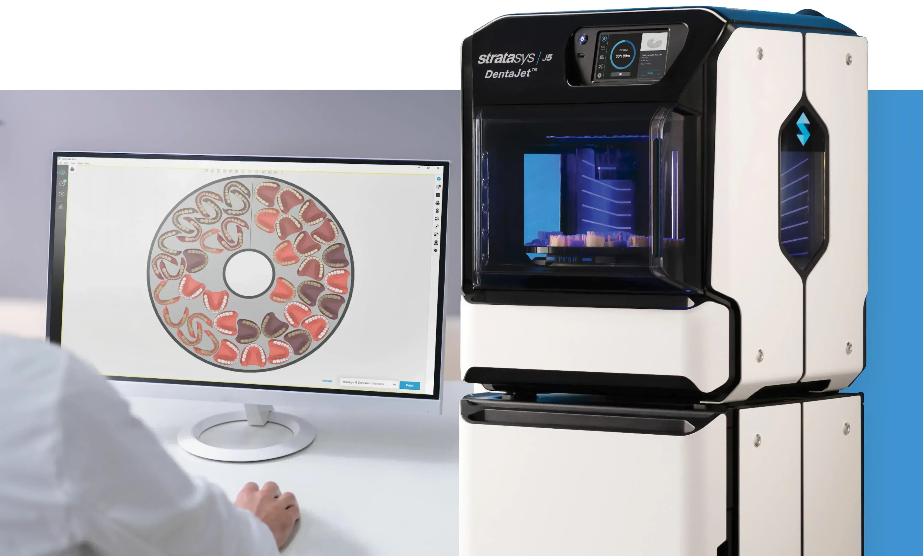 Zahnersatz aus dem 3D-Drucker – Effizient und maßgefertigt